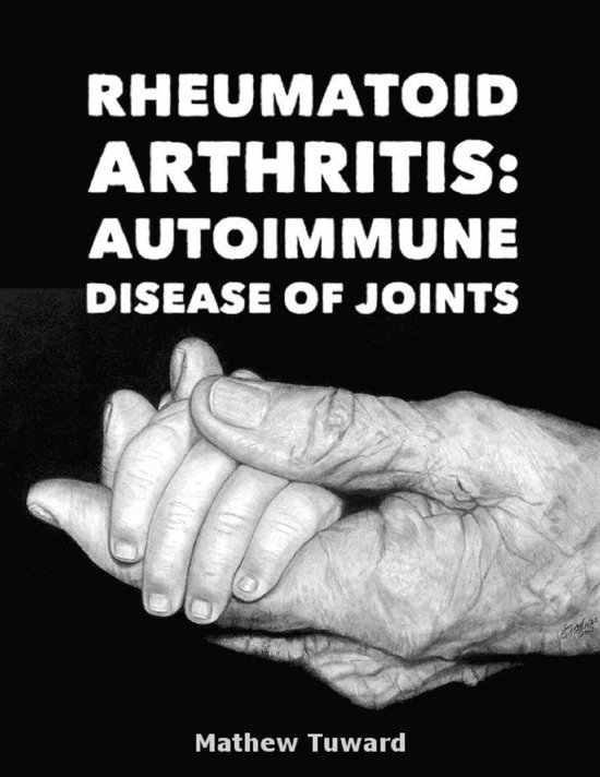 Rheumatoid Arthritis Autoimmune Disease of Joints (ebook), Mathew