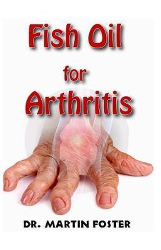 Fish Oil for Arthritis, Dr Martin Foster 9781094726229 Boeken