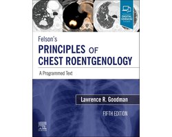 Felson's Principles of Chest Roentgenology, A Programmed Text 