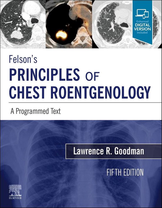 Foto: Felson s principles of chest roentgenology a programmed text