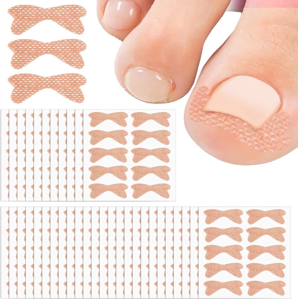 360 stuks ingegroeide teennagelpleisters voor ingegroeide teennagels | correctiepleisters, ademende correctiepleisters, geschikt voor langdurig continu gebruik
