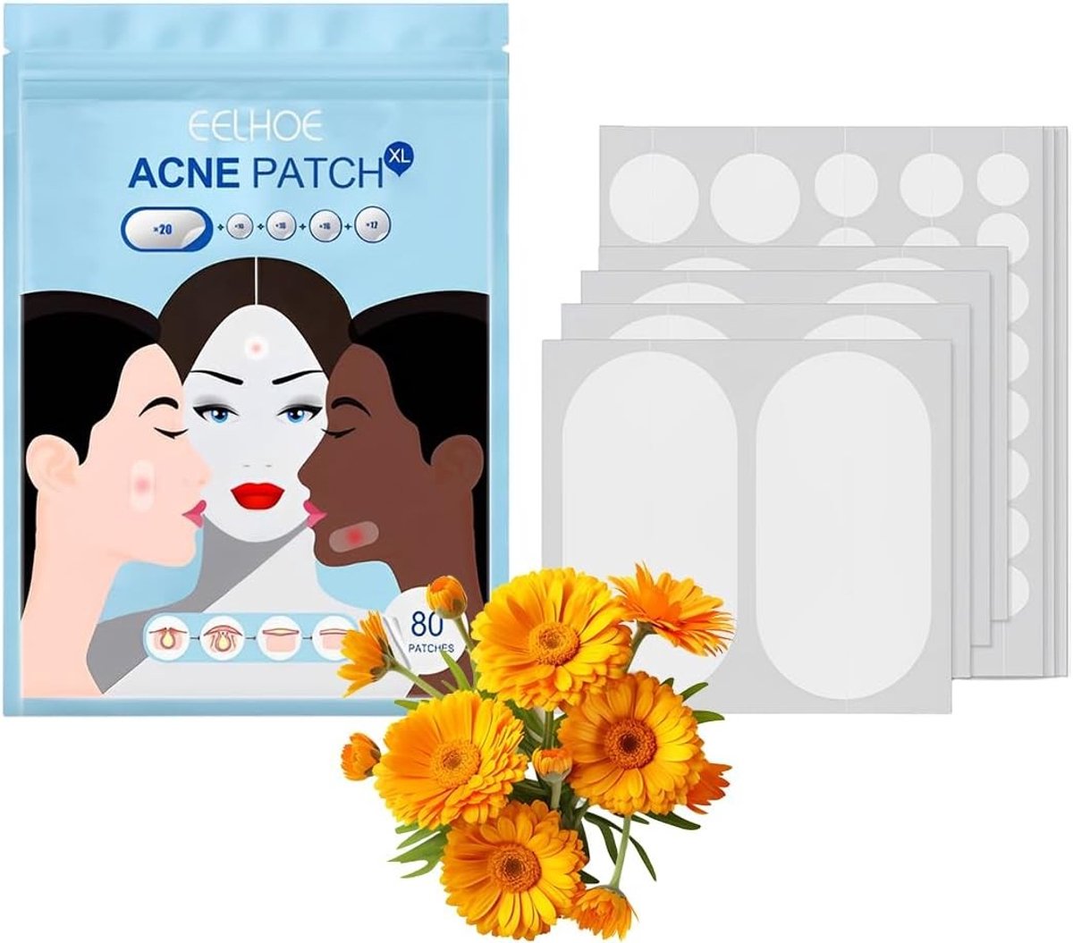 Grote puistpleisters in 5 maten, 80 patches voor gezicht en lichaam om onzuiverheden, acne en vlekken te bedekken, geschikt voor alle huidtypes