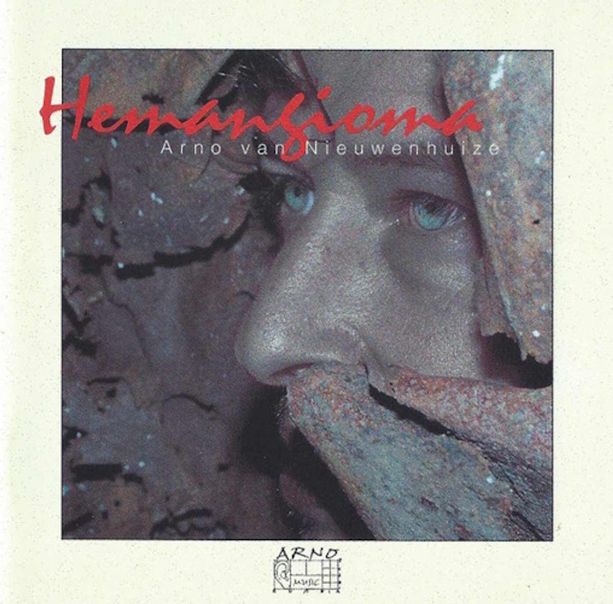 Hemangioma