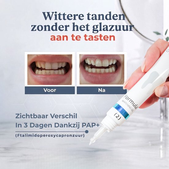 Twee foto's van tanden, links 'Voor' met gelige tanden, rechts 'Na' met wittere tanden. Een hand houdt een witte tube "Formula Whitening Gel" vast.