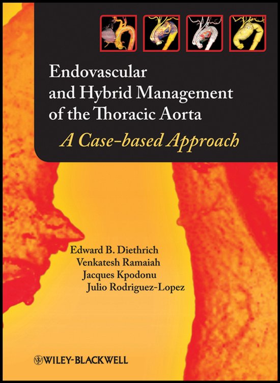 Endovascular and Hybrid Management of the Thoracic Aorta - cover