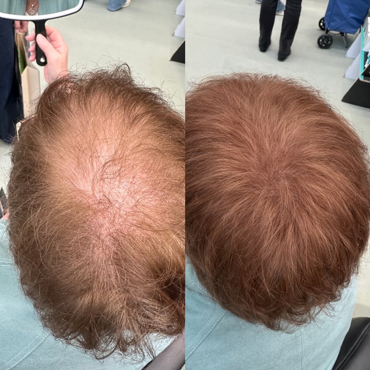 BelleLux - Uitgroei Poeder Mediumbruin – Haarmascara & Uitgroei Spray Alternatief – Grijze Uitgroei Verbergen – Waterproof – Dun Haar & Kale Plekken
