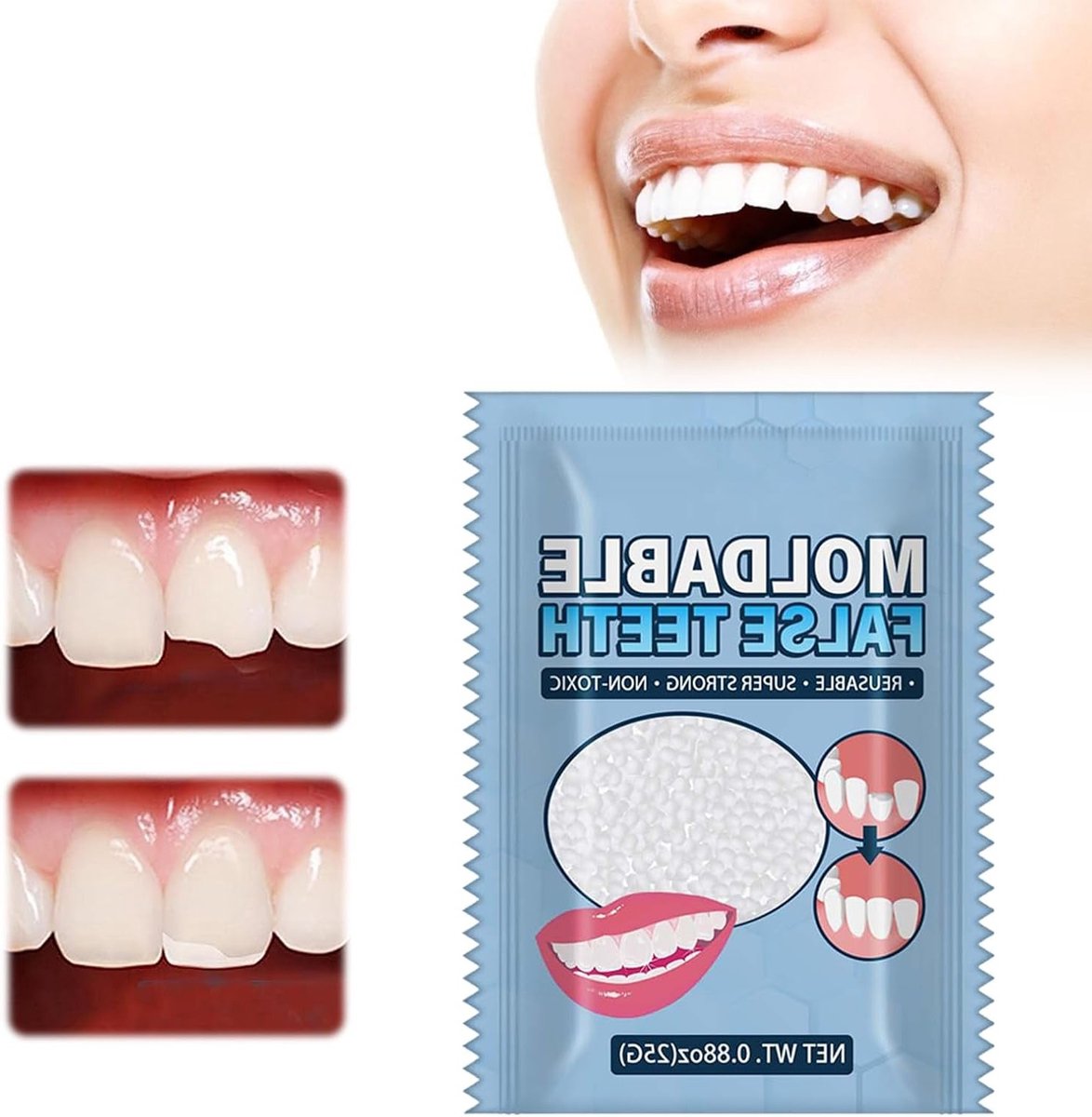 Tijdelijke Tandreparatie Kit voor Halloween: Moldbare Valse Tanden, Vulmiddel voor Gebroken Tanden en Tandherstel, 25g