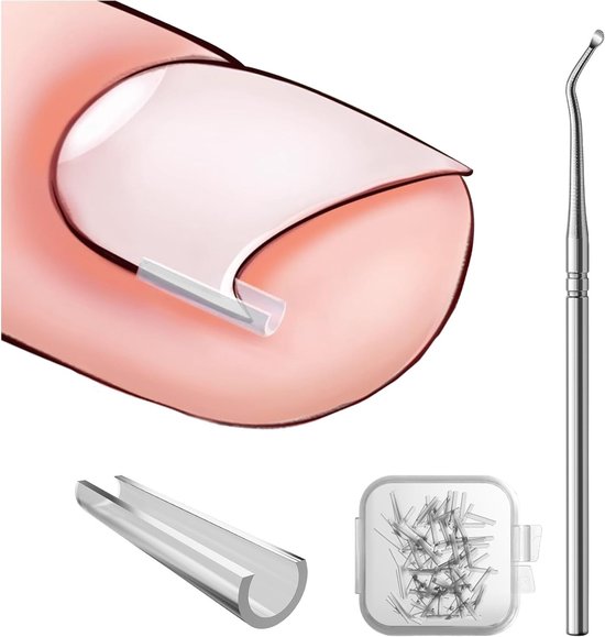 Ingrown Toenail Corrector Set - Teennagelheffer