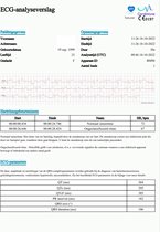 Bol.com Beurer ECG bloeddrukmeter bovenarm | ECG-functie | Bluetooth® | HealthManager pro app | BM 93 cardio | Rapport voor dokt... aanbieding