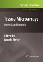 Methods in Molecular Biology- Tissue Microarrays