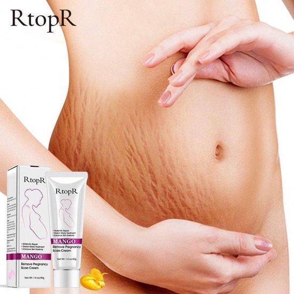Rtopr deals