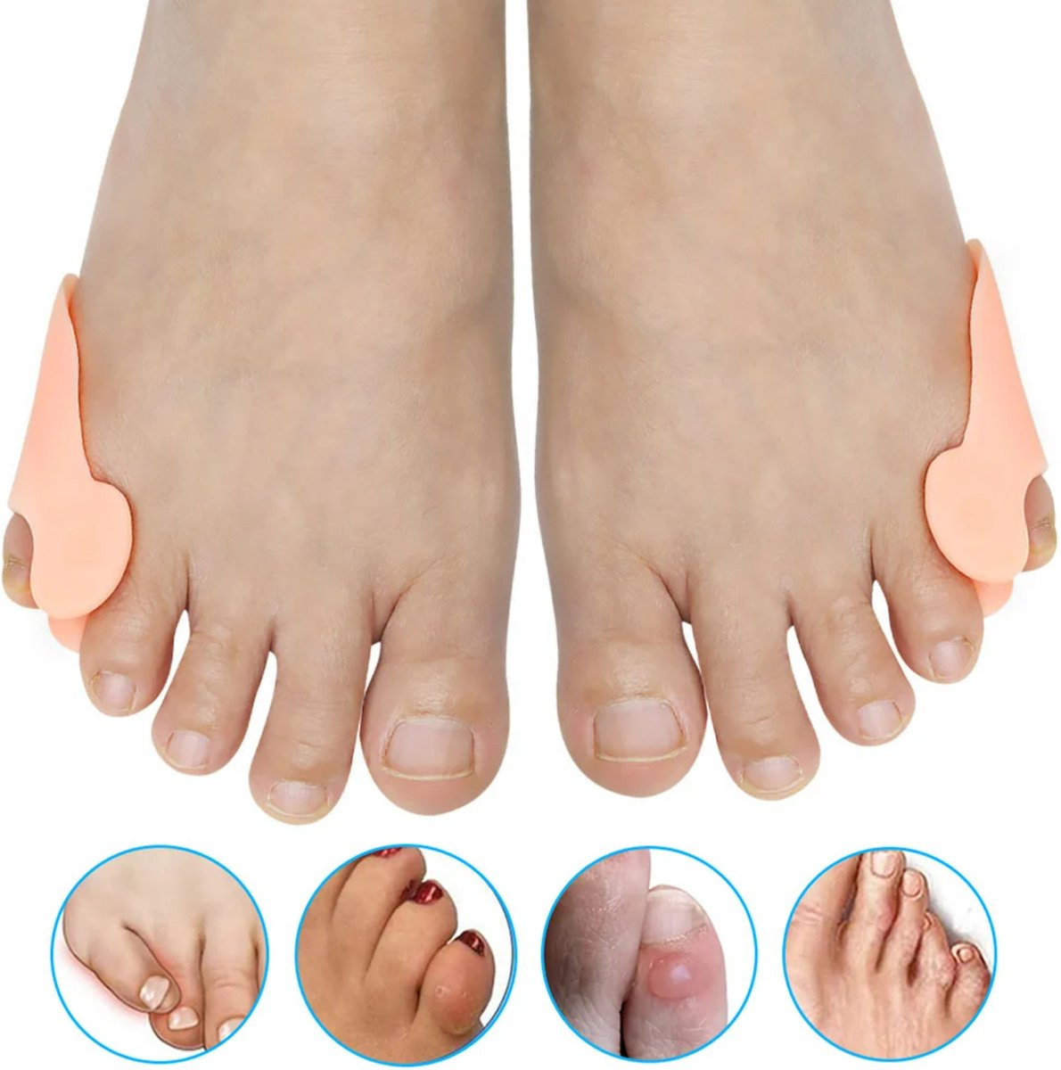 Goedkoopste 2 Stuks - Teenspreider - Teenspreider kleine teen - Teencorrector - Teenbeschermer - Teenspreiders voor hallux valgus - Teenspalk - LOUZIR