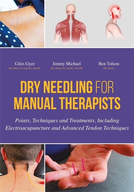 Dry Needling For Manual Therapists - cover