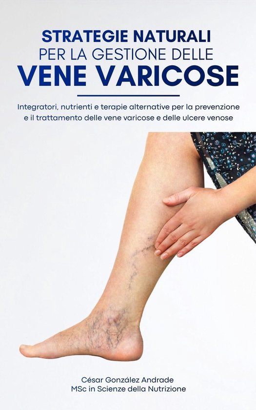 Strategie naturali per la gestione delle vene varicose - cover