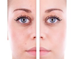 CORRECTOR MINT Kleur: Groen Doel: corrigeert roodheid, couperose, rode vlekjes en rosacea