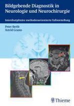 Bildgebende Diagnostik In Der Neurologie Und Neurochirurgie
