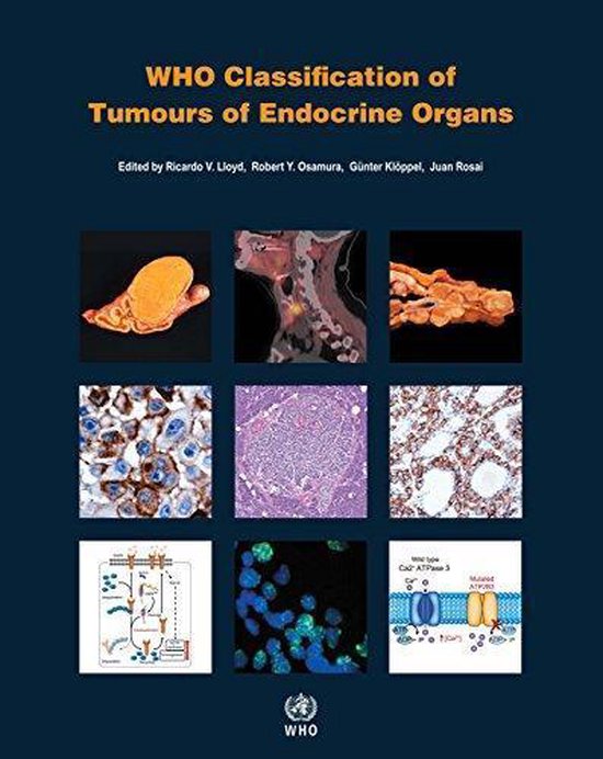 World Health Organization Classification of Tumours- WHO classification ...