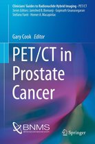 Clinicians’ Guides to Radionuclide Hybrid Imaging - PET/CT in Prostate Cancer