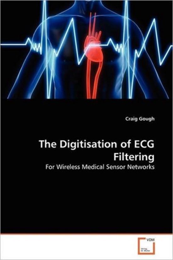 The Digitisation of ECG Filtering