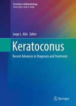 Essentials in Ophthalmology - Keratoconus