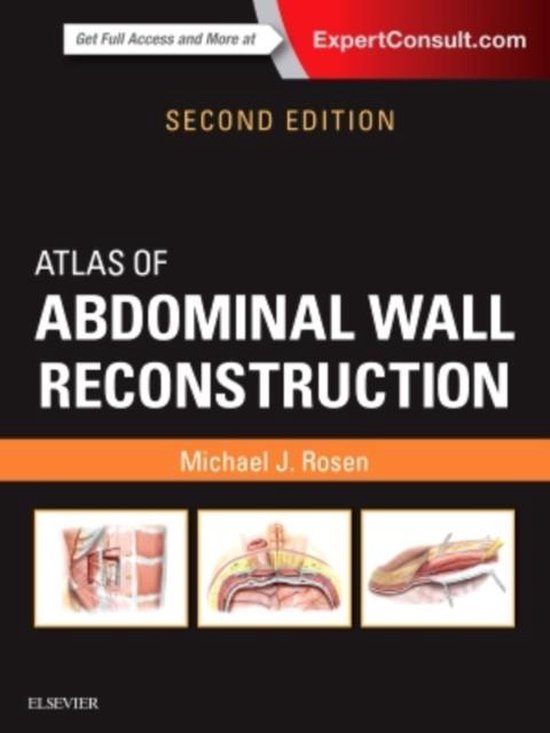 Boek cover Atlas of Abdominal Wall Reconstruction van Michael J. Rosen (Hardcover)