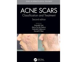 Series in Dermatological Treatment - Acne Scars