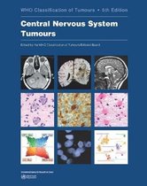 Central Nervous System Tumours: Who Classification of Tumours