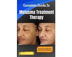 Complete Guide To Melasma Treatment Therapy