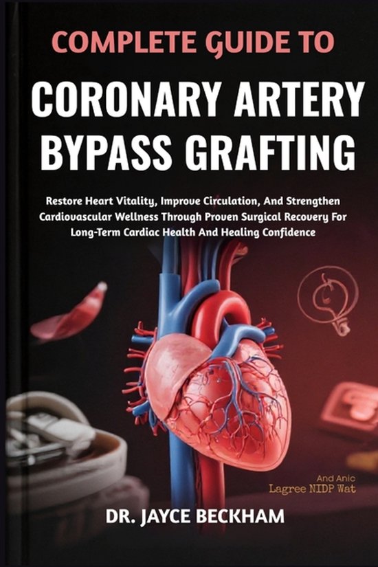 Complete Guide to Coronary Artery Bypass Grafting, Jayce Beckham ...