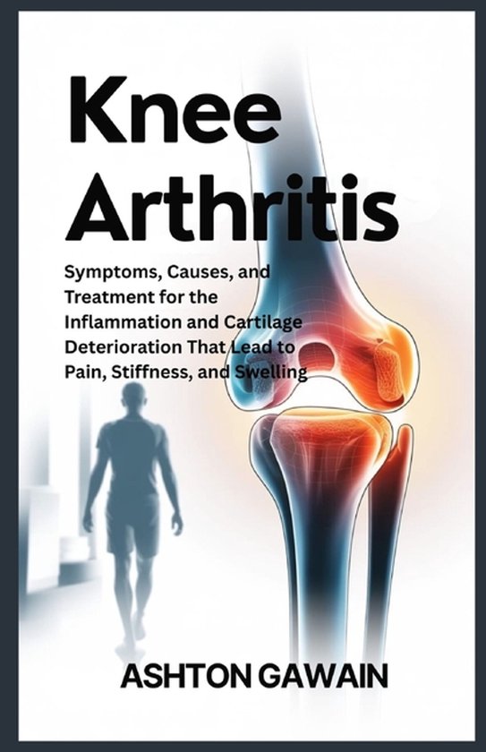 Knee Arthritis - cover