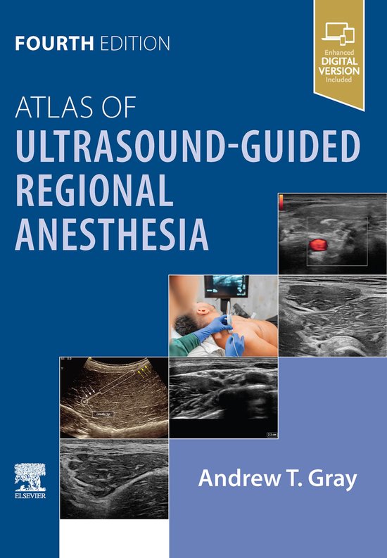 Atlas of Ultrasound-Guided Regional Anesthesia - E-BOOK - cover