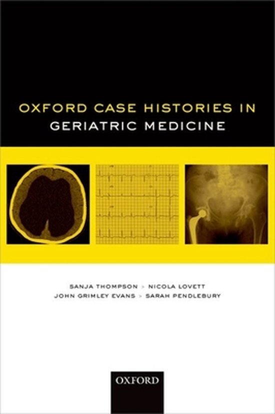 Oxford Case Histories in Geriatric Medicine 9780199699261 Sanja Thompson Boeken