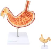 Het menselijk lichaam - anatomie model maag met maagzweer (23x19x2 cm)