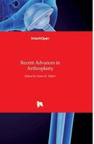 Recent Advances in Arthroplasty