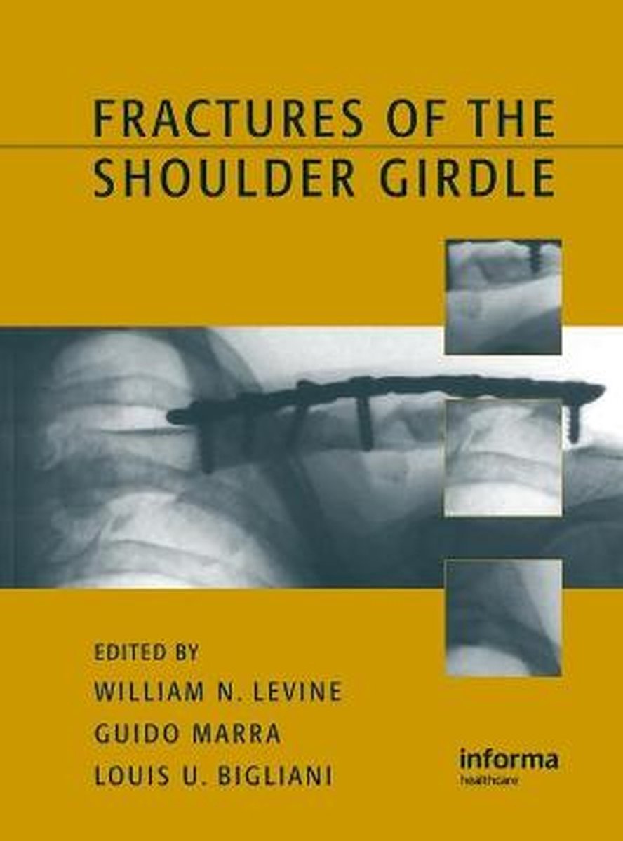 Fractures of the Shoulder Girdle - William N. Levine