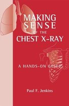 Making Sense Of The Chest X-Ray