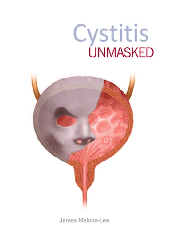 Cystitis Unmasked - cover