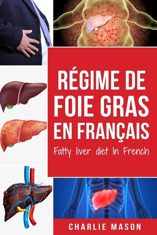 Régime de foie gras En français/ Fatty liver diet In Frenc ... - cover