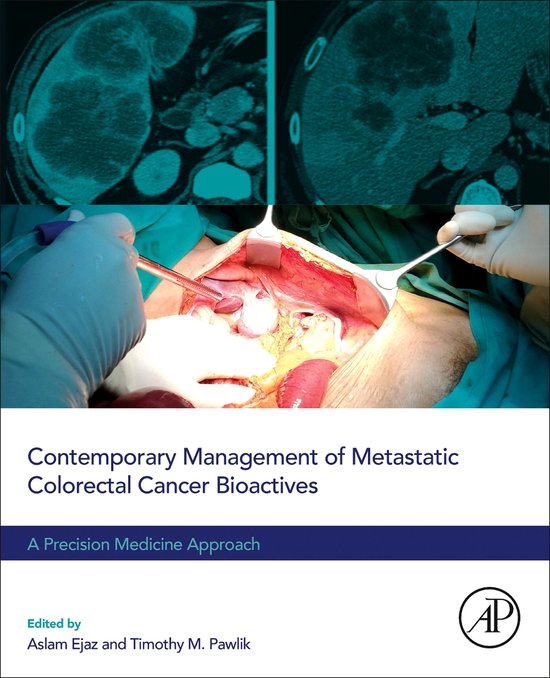 Contemporary Management of Metastatic Colorectal Cancer - cover