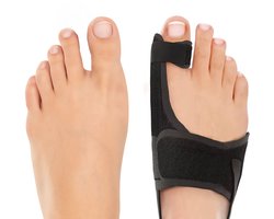 Hoge Kwaliteit Hallux Valgus Brace Grote Teen Set van 2 – Nachtspalk, Brace, Beschermer, Teenspreider, Sokken en Schoenen, Teenbrace, Teen brace