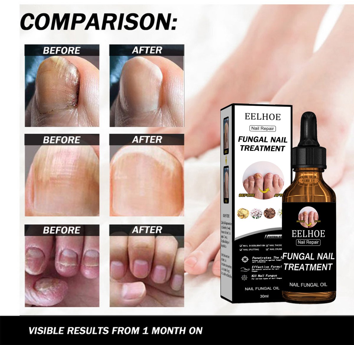 EELHOE Nagel Herstel Oplossing – Versterkend, Hydraterend & Beschermend – Glycerine, Hydrolyzed Tarweproteïne & Keratine – Nail Care 30 ml