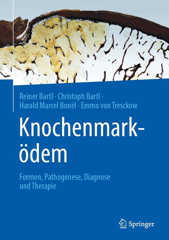Medicine (German Language) - Knochenmarködem - cover
