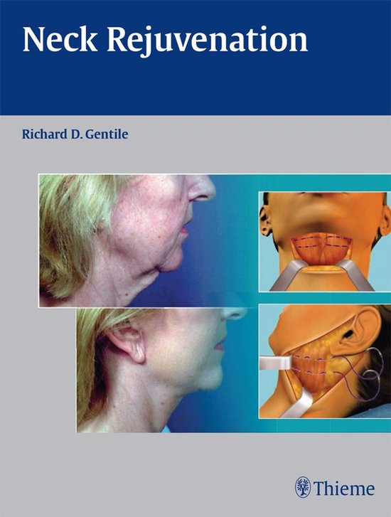 Neck Rejuvenation - cover
