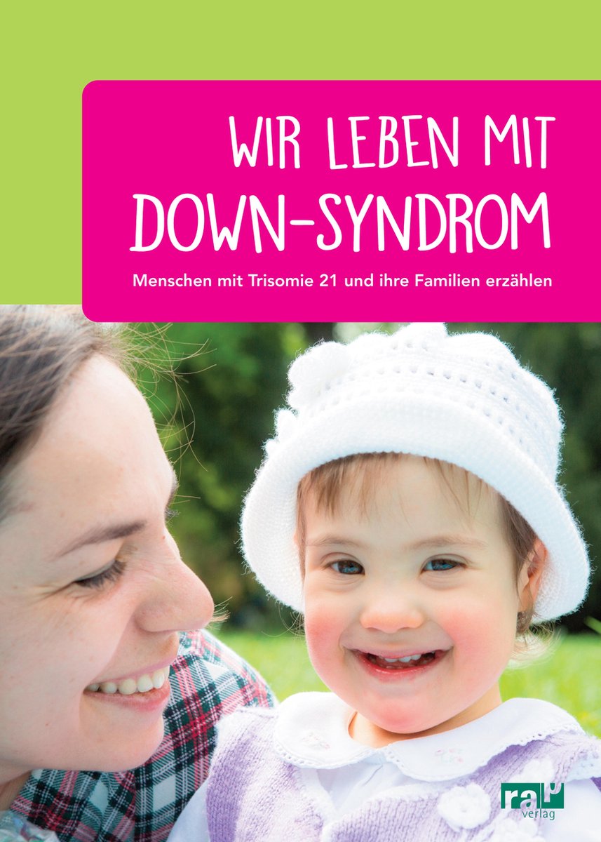 Syndrom down Down Syndrome