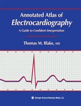 Contemporary Cardiology - Annotated Atlas of Electrocardiography