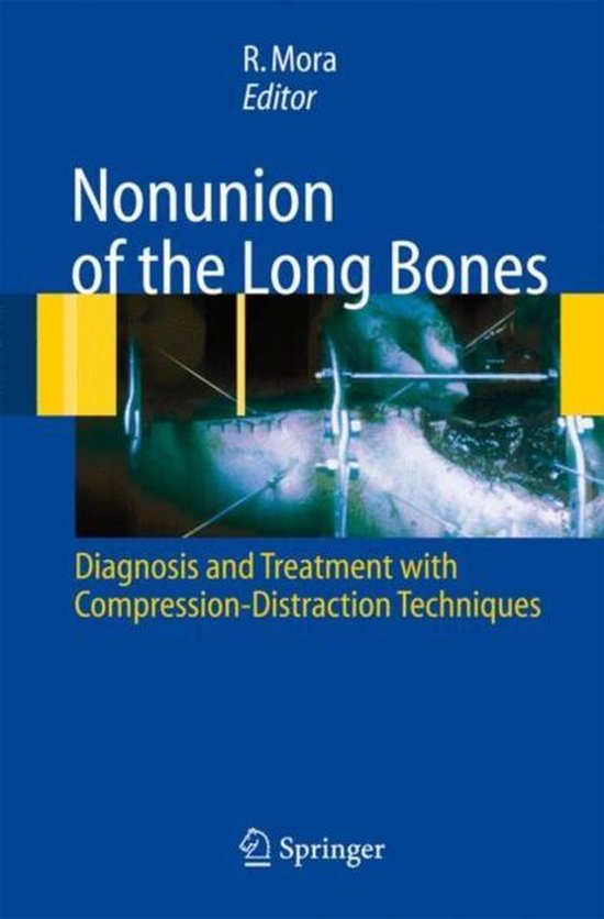 Nonunion of the Long Bones - cover
