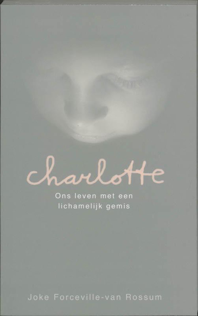 Voorzijde van het boek Charlotte: Ons leven met een lichamelijk gemis. Met een wazige kindergezicht en de titel in roze letters.