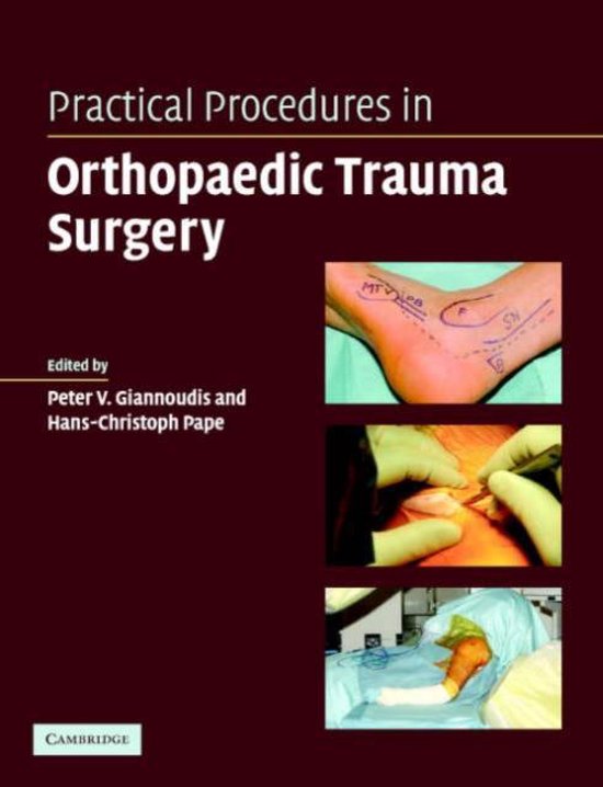 Practical Procedures In Orthopaedic Trauma Surgery - cover