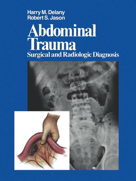 Medicine (R0) - Abdominal Trauma - cover