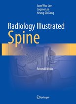 Radiology Illustrated - Radiology Illustrated: Spine